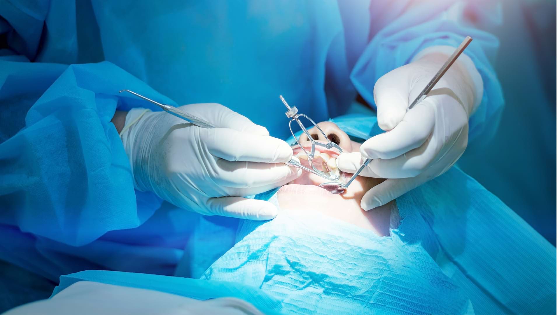 64eca640d6da56aa35647278_periodontal-cerrahi-periodonta-blog