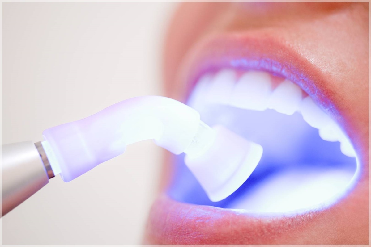 Female patient in deltal office receiving dental filling drying procedure.